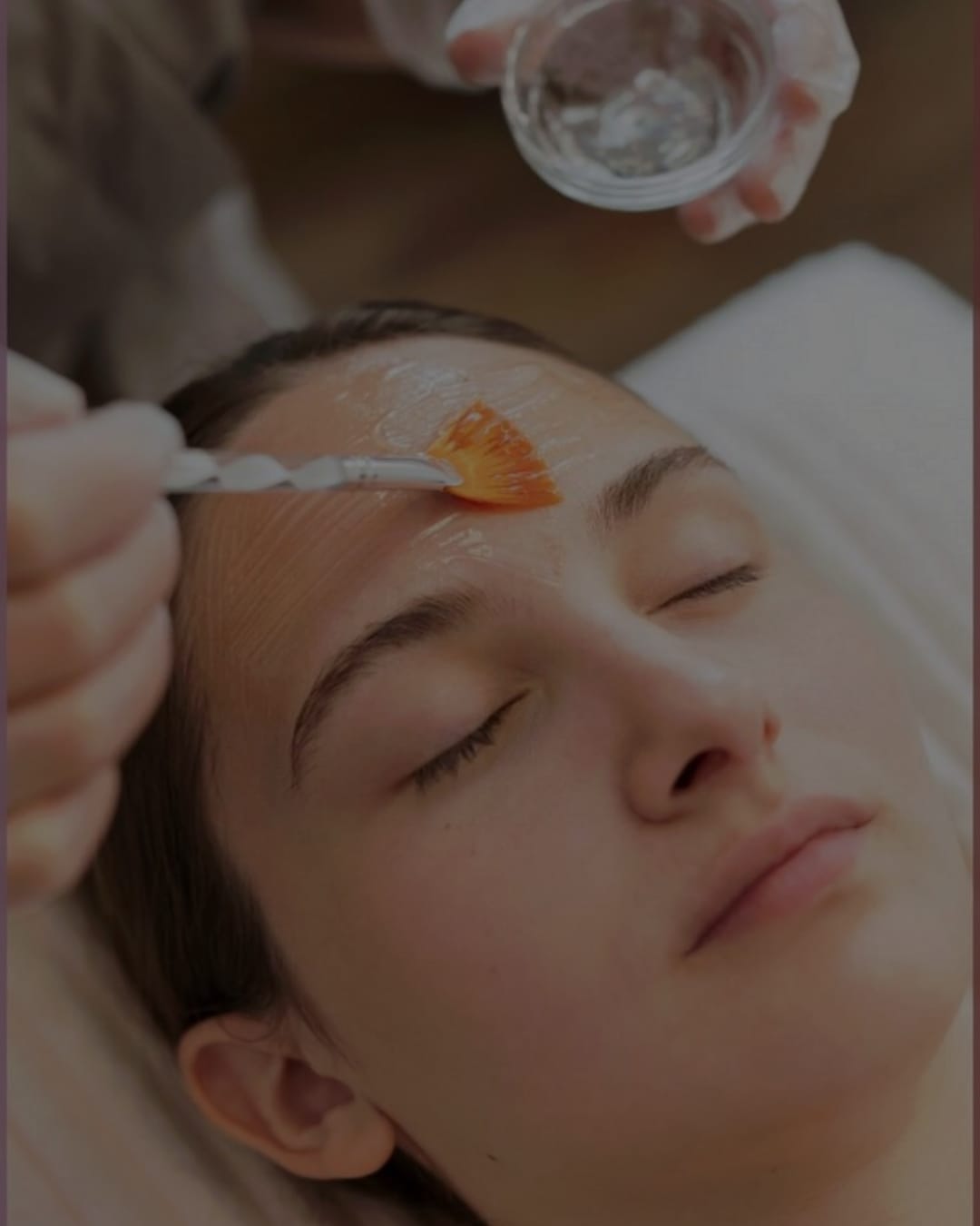 Pack Peeling Químico/Mecanico x4