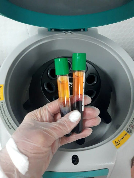 Plasma Rico en Plaquetas