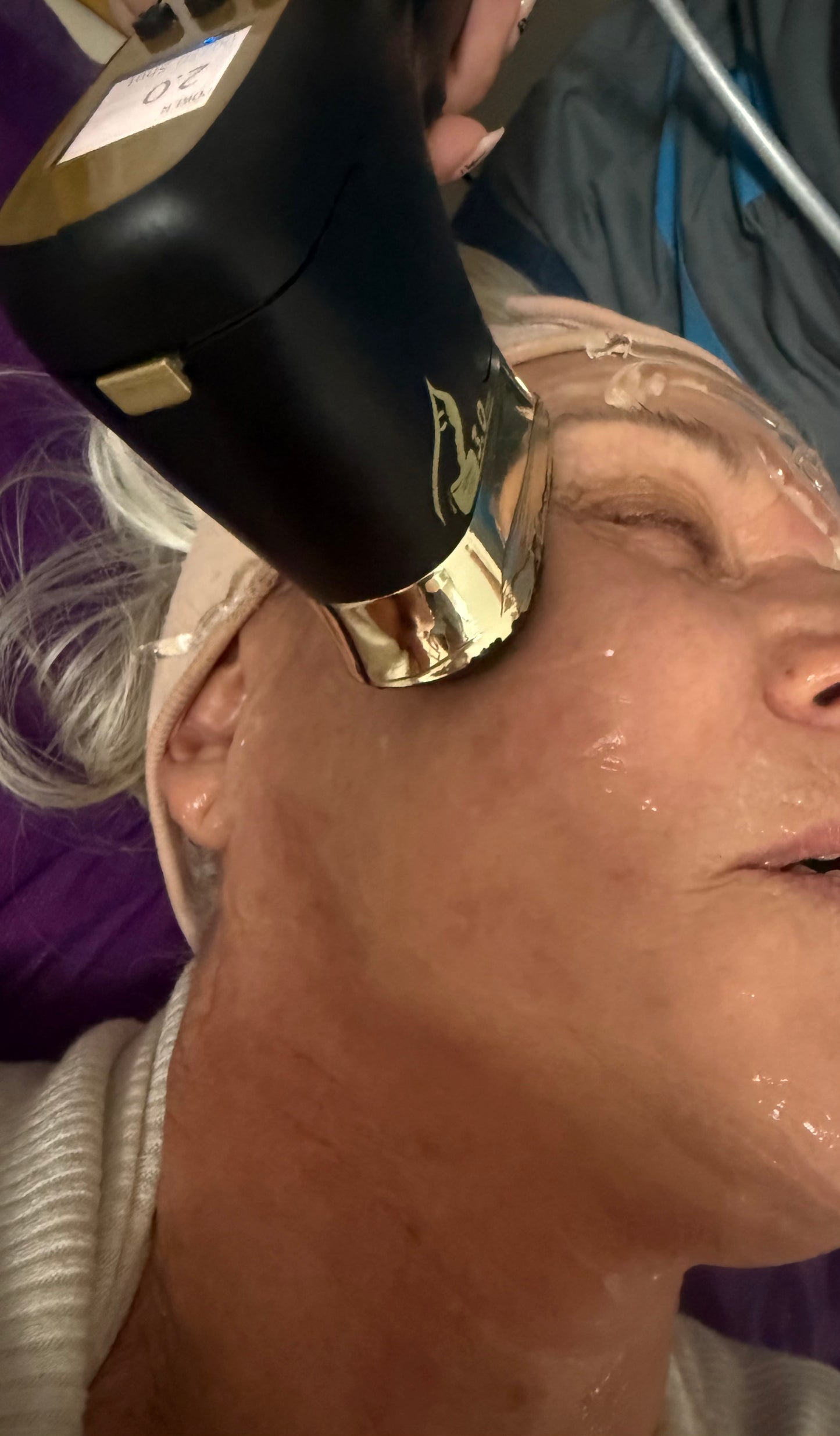 HIFU 22 D Facial