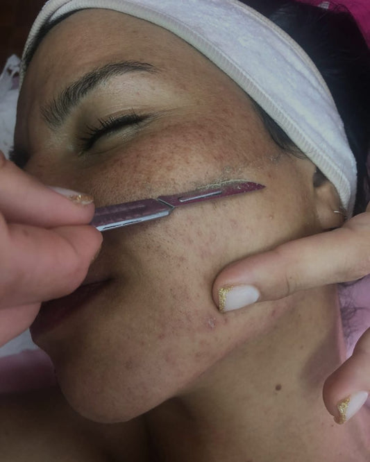 Dermaplaning + Luminoterapia