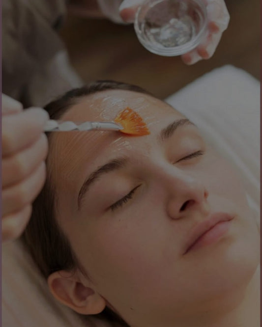 Pack Peeling Químico/Mecanico x4