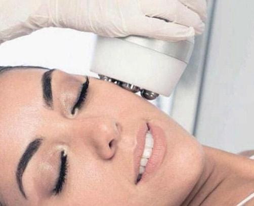 Crioradiofrecuencia Facial y Corporal