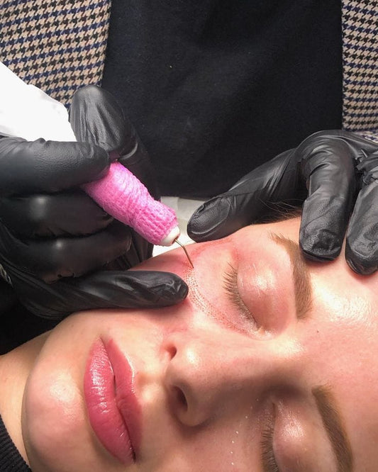 Plasma pen ó Fibroblast