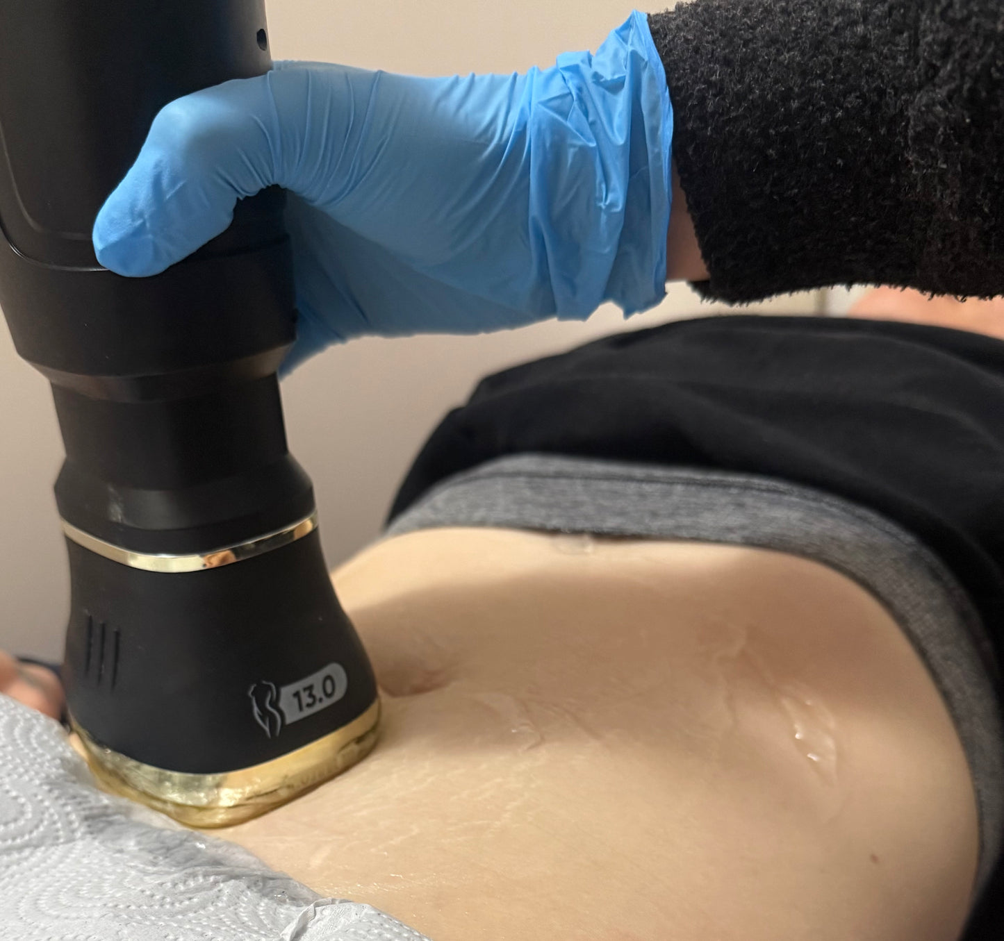 Liposonix - Descuento con codigo LIPOAGOSTO