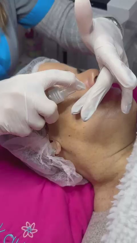 Mesoterapia Facial virtual